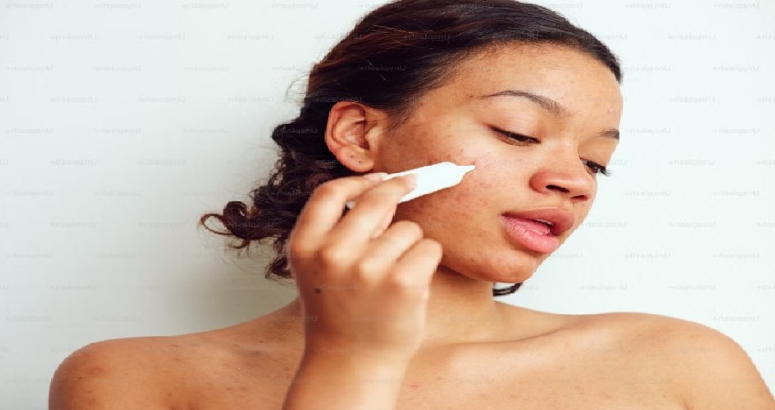 Best Hospital In New York For Acne Treatment.jpg