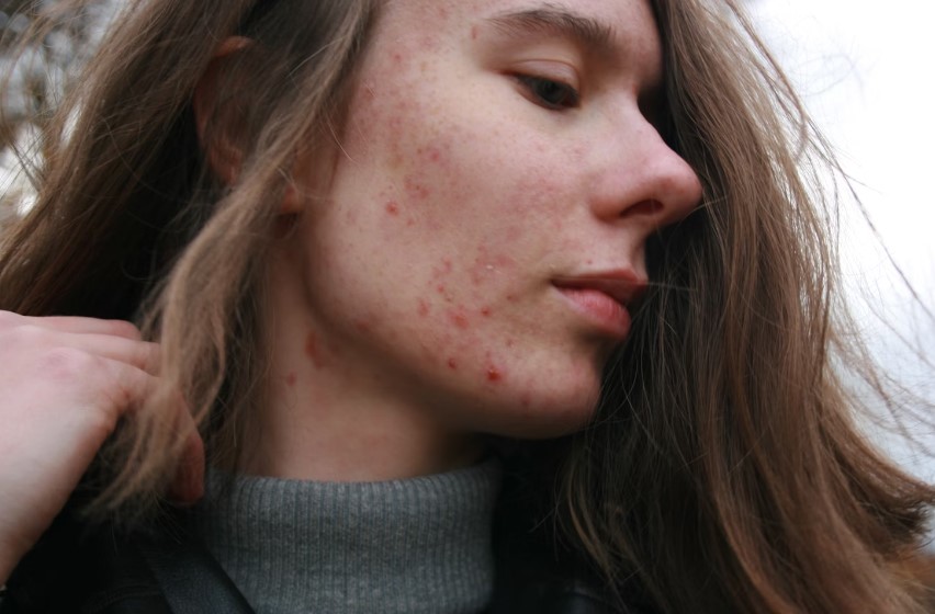 Best Hospitals In California For Skin Problems.jpg