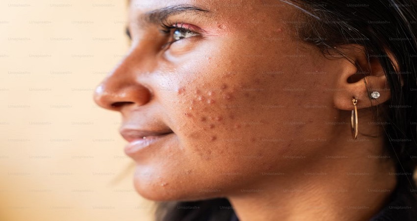 Best Hospitals In Washington For Skin Problems.jpg