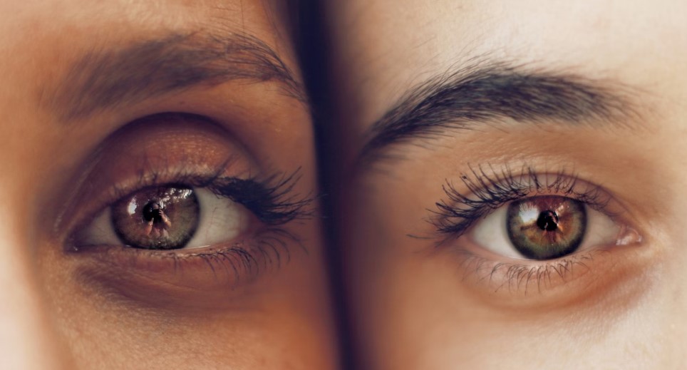 Best Eye Hospital In Hyderabad For Squint Surgery.jpg