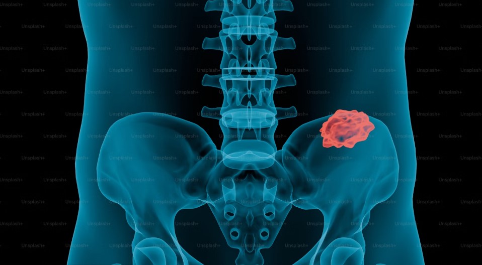 Best Hospital In Hyderabad For Cervical Spondylosis.jpg